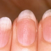 「顔出しＯＫです！」【長期モニター】フランス発のネイルエッセンス現品モニター募集の投稿画像