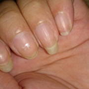 「ネイル」【長期モニター】フランス発のネイルエッセンス現品モニター募集の投稿画像