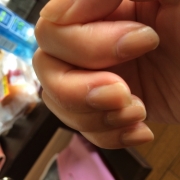 「ささくれ」【長期モニター】フランス発のネイルエッセンス現品モニター募集の投稿画像