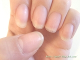 口コミ：体の中からネイルケア♪【ネイ美ッシュ】の画像（1枚目）