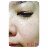 「高濃度炭酸スリーピングマスク☆モニター☆」の画像