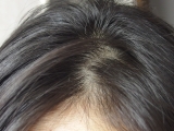 「頭皮は完璧です」の画像（3枚目）