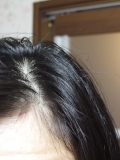 「頭皮は完璧です」の画像（1枚目）