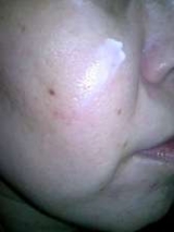 口コミ：紫根クリーム@株式会社自然化粧品研究所/感想の画像（1枚目）