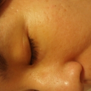 「肌悩み・・・」【長期モニター】馬乳60%配合高栄養クリーム！モニター大募集！の投稿画像