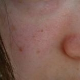 「シミと毛穴ぶつぶつして見えて改善したいです。」【長期モニター】馬乳60%配合高栄養クリーム！モニター大募集！の投稿画像