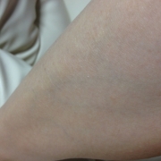 「カサカサ(T ^ T)」【長期モニター】馬乳60%配合高栄養クリーム！モニター大募集！の投稿画像