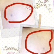 「消すぞこのシミ！」【長期モニター】デルミサ　ヒートショックセラム現品モニター大募集！の投稿画像