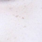 「シミ・・・」【長期モニター】デルミサ　ヒートショックセラム現品モニター大募集！の投稿画像