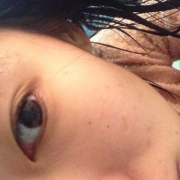 「顔のしみ」【長期モニター】デルミサ　ヒートショックセラム現品モニター大募集！の投稿画像