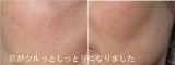 口コミ:ビタミンCスキンケア!プリモディーネお試しの画像(7枚目)
