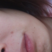 「法令線とたるみと頬のこけ」来年春発売予定！プラセンタ原液モニター大募集！の投稿画像