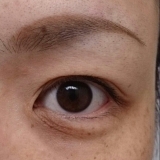 目の下の涙袋のところ！！