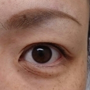 「目の下の涙袋のところ！！」来年春発売予定！プラセンタ原液モニター大募集！の投稿画像