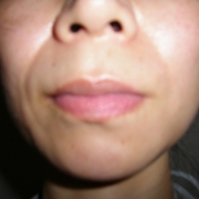 「ほうれい線」来年春発売予定！プラセンタ原液モニター大募集！の投稿画像