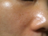 「毛穴」の画像（1枚目）