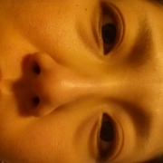 「若い頃顔も焼いていました」【東海エリア限定】顔や手のふくらみのあるシミ広告用イメージモデル大募集！の投稿画像