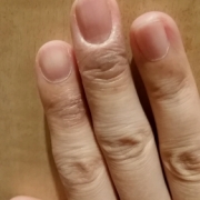 「30年間の悩み」<アトピーでお悩みの方>ブログ不要！！あなたを長期サポート☆夢を応援します☆の投稿画像