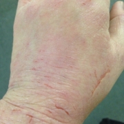 「アレルナイト」<アトピーでお悩みの方>ブログ不要！！あなたを長期サポート☆夢を応援します☆の投稿画像