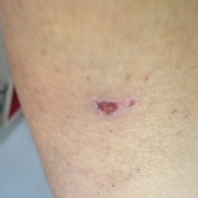 「アトピー歴18年」<アトピーでお悩みの方>ブログ不要！！あなたを長期サポート☆夢を応援します☆の投稿画像