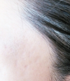 「美容液を使用し始めて3日目です。」の画像（1枚目）