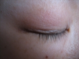 現状のまつげ