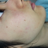 「ベルブランを使ってみて」の画像（3枚目）