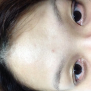 「ニキビ跡と毛穴」薬用ニキビケア【アクネル アクネクリアローション＋AZセラム】を20名様に！の投稿画像