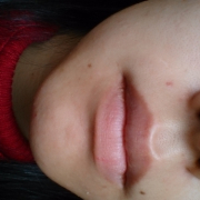 「オードムーゲ」薬用ニキビケア【アクネル アクネクリアローション＋AZセラム】を20名様に！の投稿画像