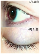 口コミ：産毛が生えてきた♪まつげ美容液のベルダ アイラッシュセラムの画像（7枚目）