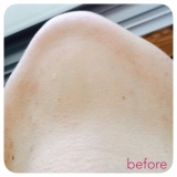 「before-after画像」の画像（1枚目）