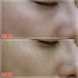 「泡パック1回で違いがわかるよ！」の画像