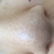 「毛穴」鼻の角栓にお悩みの方限定♪美容オリーブオイルで『いちご鼻ケア』♪の投稿画像