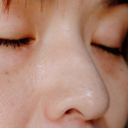 「小粒な点々＝にっくき角栓」鼻の角栓にお悩みの方限定♪美容オリーブオイルで『いちご鼻ケア』♪の投稿画像