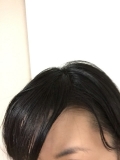 「頭皮がしっかり潤いました。」の画像（2枚目）