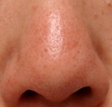 「初日・・・」の画像（1枚目）