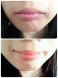 「before&rarr;after」の画像（1枚目）