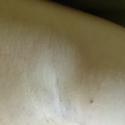 「これ以上肌を汚すのが怖いです」【ワキモデルさん30名募集！】化粧品の販売ページ、チラシ、販促物の出演モデル募集の投稿画像