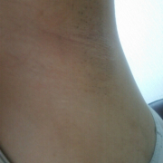 「私の脇」【ワキモデルさん30名募集！】化粧品の販売ページ、チラシ、販促物の出演モデル募集の投稿画像