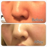 「☆毛穴の汚れや黒ずみをスッキリとケア☆」の画像