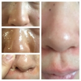 「毛穴の汚れをスッキリ落としたい！メルティベリー オレンジリッチをお試し、」の画像