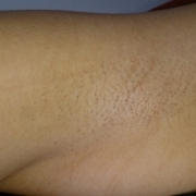 「剃ってから一晩」【わきモデルさん３０名再募集】化粧品の販売ページ、チラシ、販促物の出演モデル募集の投稿画像