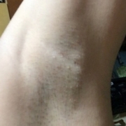 「色素沈着」【わきモデルさん３０名再募集】化粧品の販売ページ、チラシ、販促物の出演モデル募集の投稿画像