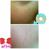 「なめらかなツルツル肌になれました♪」の画像