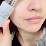 「治るといいなっ!!!!」の画像