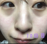 「みるみると、、」の画像（3枚目）