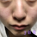 みるみると、、