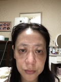 毛穴の開き