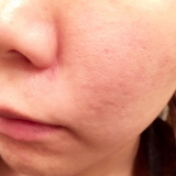 「2週間使えました♪」の画像（1枚目）