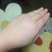 「大人ニキビ」【モニター20名様！】新発売！あごニキビに悩む方へのCCクリーム5000円相当の投稿画像